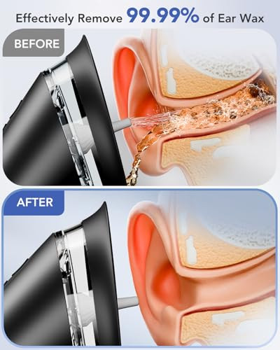 YAKBIO ELECTRIC EAR CLEANER WITH LED DISPLAY, EAR WAX CLEANER - BLACK