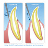 Straight Tip Elevator 1mm - Stubby Handle