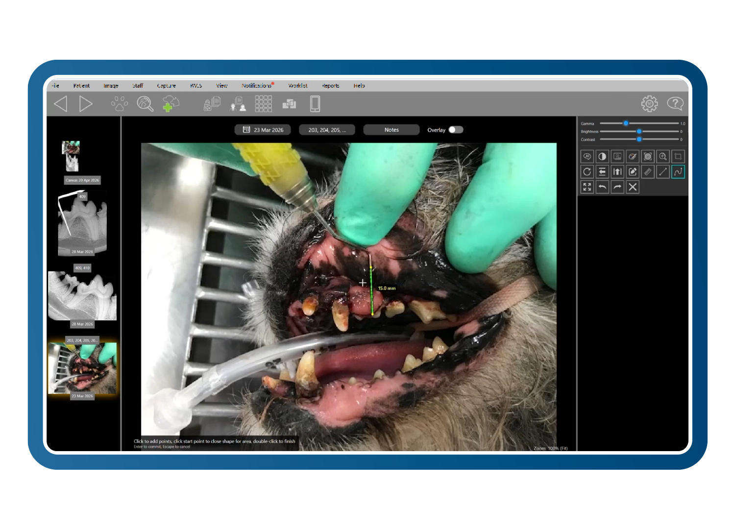 Clarity-XR-Software-Oral-Mass-Measurement