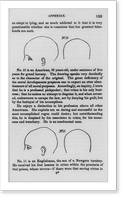Historic Framed Print, [Engraving by Tudor Horton, based on daguerreotypes by Mathew Brady, printed in Sampson's Rationale of Crime...1846 (phrenological studies): head measurements of two pickpockets],  17-7/8" x 21-7/8"