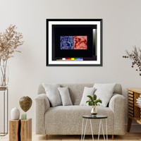 Visualization image for AIDS related pneumonia Classic, Antique Wall Art