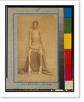 Historic Framed Print, [A Federal prisoner, returned from prison, full-length, seated, nude, facing front],  17-7/8" x 21-7/8"