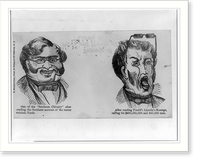 Anti-Confederacy cartoon showing Southerner's reaction to Lincoln's determination, Antique Print