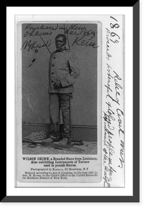 Historic Photo Print - Wilson Chinn, a branded slave from Louisiana