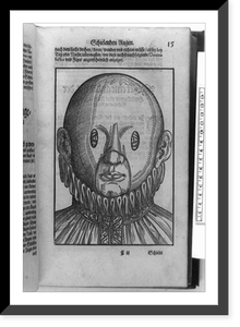 Person with crossed eyes wearing corrective mask, head-and-shoulders view, Vintage Wall Art