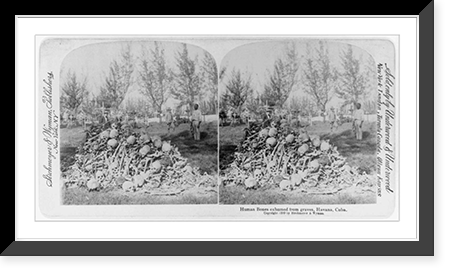 Human bones exhumed from graves, Havana, Cuba, Vintage Wall Art