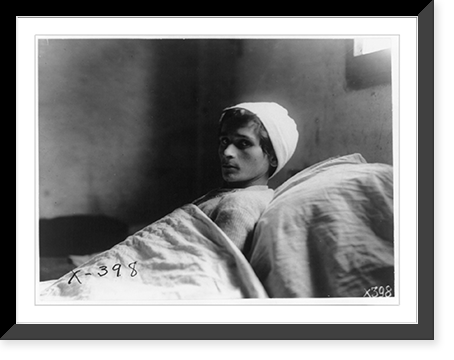 Giuseppi Ugesi, an Italian soldier who was wounded, confined in a hospital bed with tuberculosis, Vintage Print