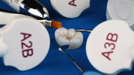 Molar Septum Expansion Facilitates Predictable Management of Dense Posterior Bone