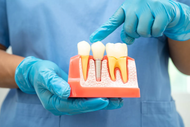 How to Approach Site Preparation Across Implant Systems