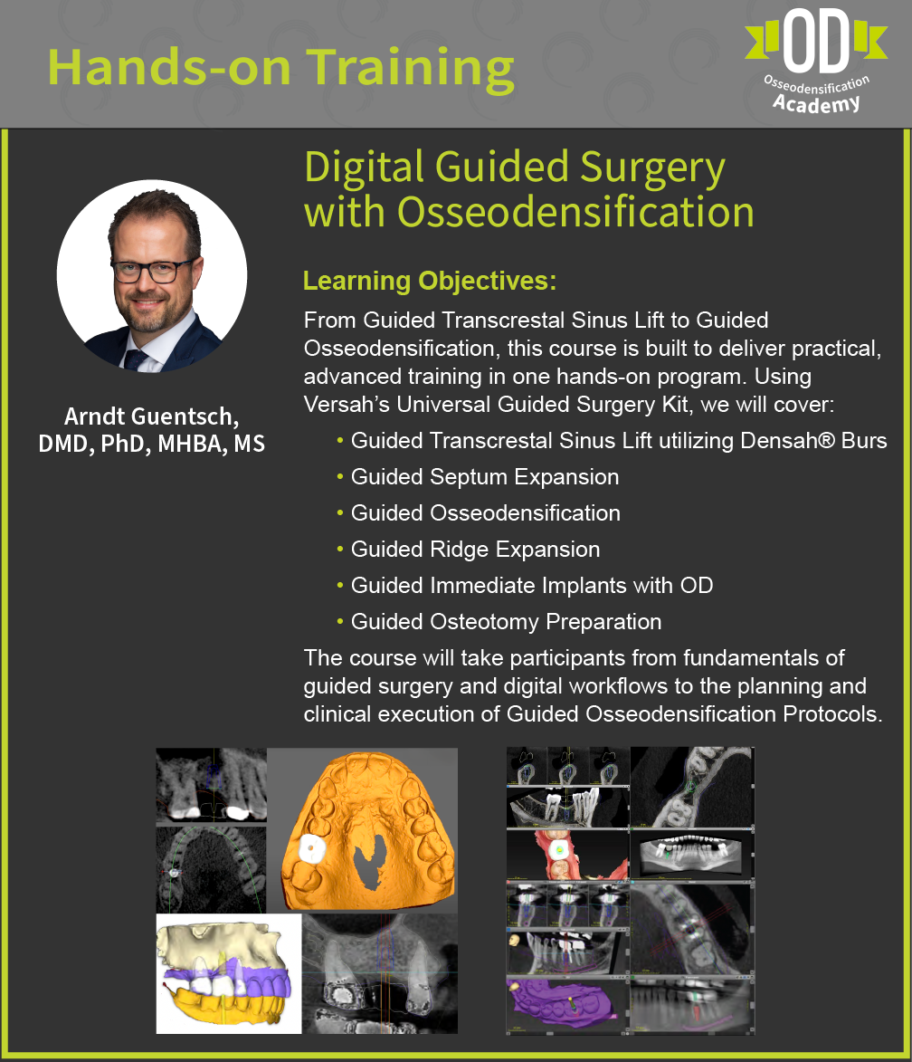 Digital Guided Surgery with Osseodensification