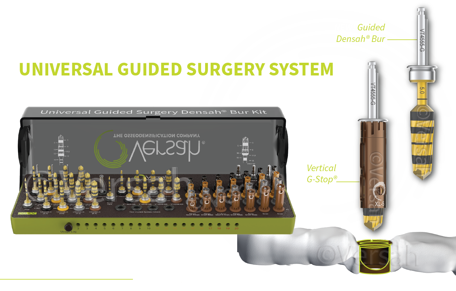 New! Universal Guided Surgery System Densah® Bur Kit