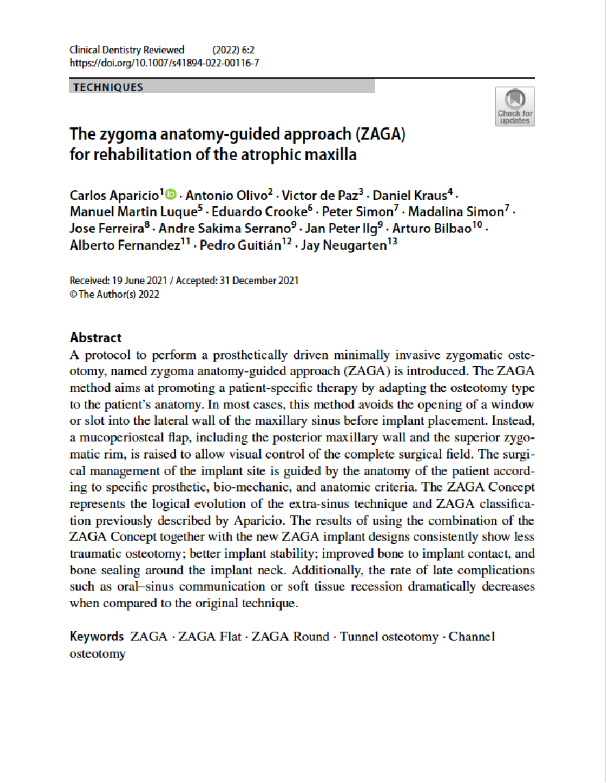 This article describes the combined use of the immediate dentoalveolar restoration (IDR) technique and an osseodensification implant site preparation method to improve immediate implant primary stability in periodontally compromised extraction sites. Positioning of soft and hard tissues was evaluated in two clinical cases in which the IDR technique and the osseodensification implant site preparation method were used to replace teeth at sites with severe alveolar bone loss. The results were analyzed by clinical assessment, photography, radiography, and computed tomography scans. Based on this preliminary study, the use of osseodensification can enhance the results achieved using the IDR technique due to improved primary implant stability, as measured by higher insertion torque. Int J Periodontics Restorative Dent 2019;39:xxx–xxx. doi: 10.11607/prd.3883