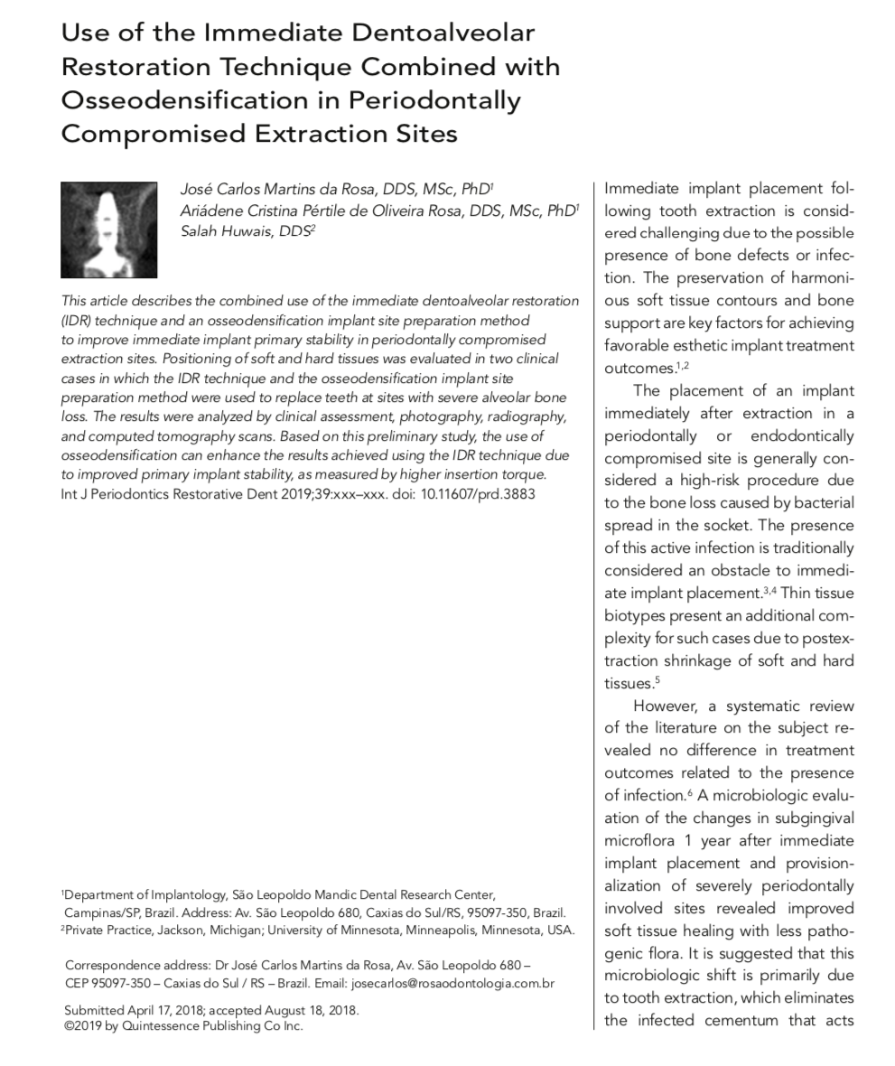 This article describes the combined use of the immediate dentoalveolar restoration (IDR) technique and an osseodensification implant site preparation method to improve immediate implant primary stability in periodontally compromised extraction sites. Positioning of soft and hard tissues was evaluated in two clinical cases in which the IDR technique and the osseodensification implant site preparation method were used to replace teeth at sites with severe alveolar bone loss. The results were analyzed by clinical assessment, photography, radiography, and computed tomography scans. Based on this preliminary study, the use of osseodensification can enhance the results achieved using the IDR technique due to improved primary implant stability, as measured by higher insertion torque. Int J Periodontics Restorative Dent 2019;39:xxx–xxx. doi: 10.11607/prd.3883