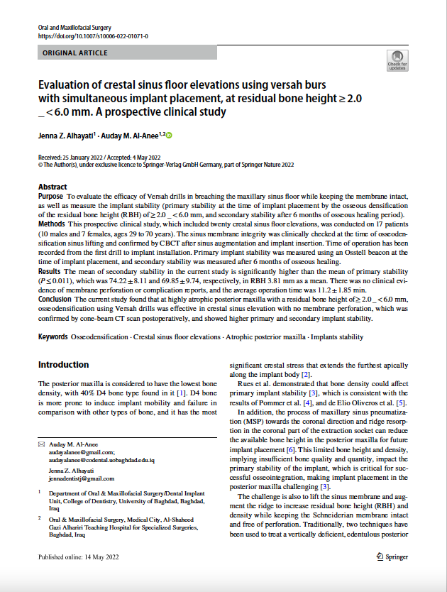 Pneumatization of the maxillary sinus poses a great challenge for implant placement & restoration in the posterior maxilla. Direct sinus augmentation techniques have shown very good success rates, but the major drawback with this technique is patient satisfaction with regard to morbidity and waiting period for restoration. Today with innovative osseodensification burs and an innovative graft delivery system, crestal sinus augmentation can be used to achieve significant antral membrane elevation and enhanced stability of the implants even in low residual bone height(RBH).