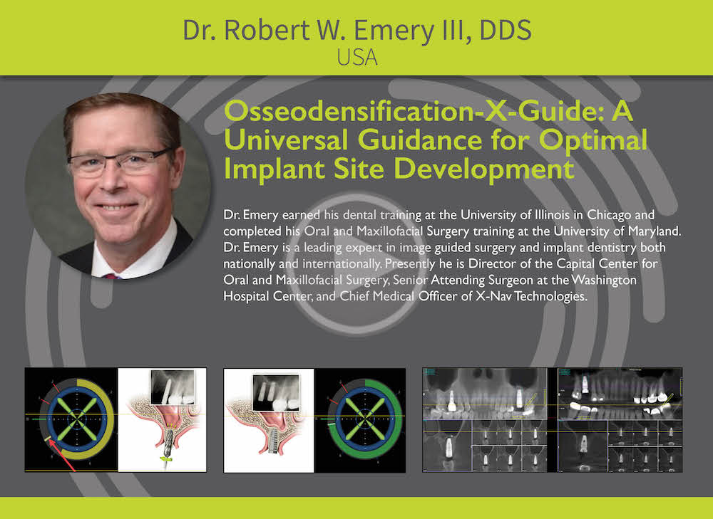 Osseodensification-X-Guide: A Universal Guidance for Optimal Implant Site Development