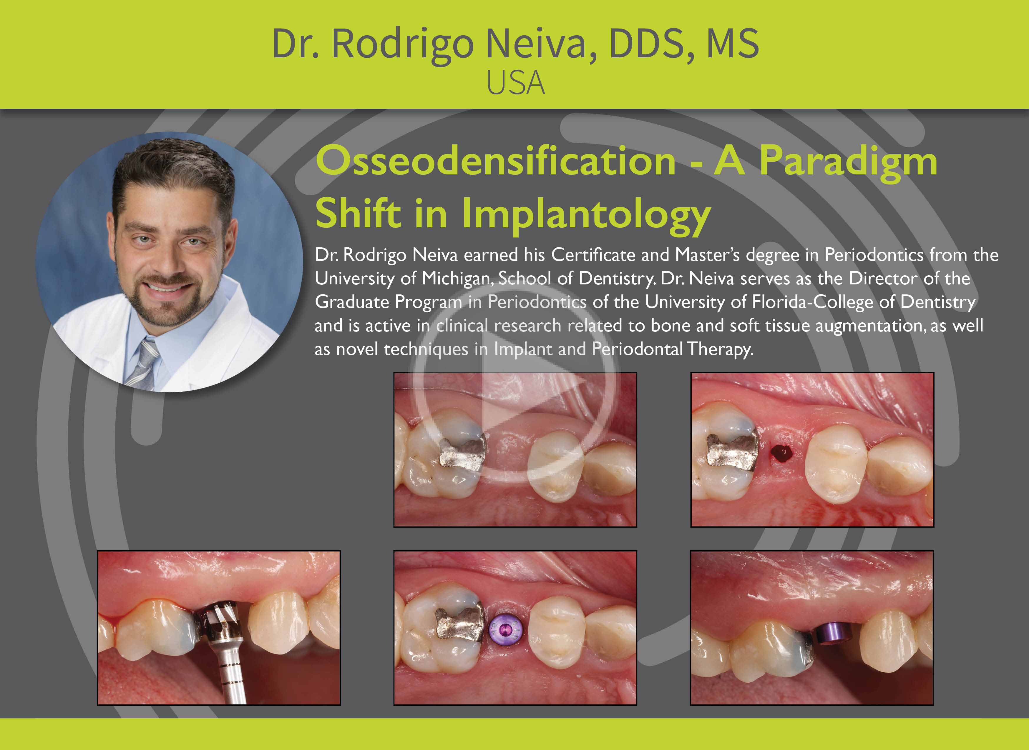 Osseodensification: A Paradigm Shift in Implantology