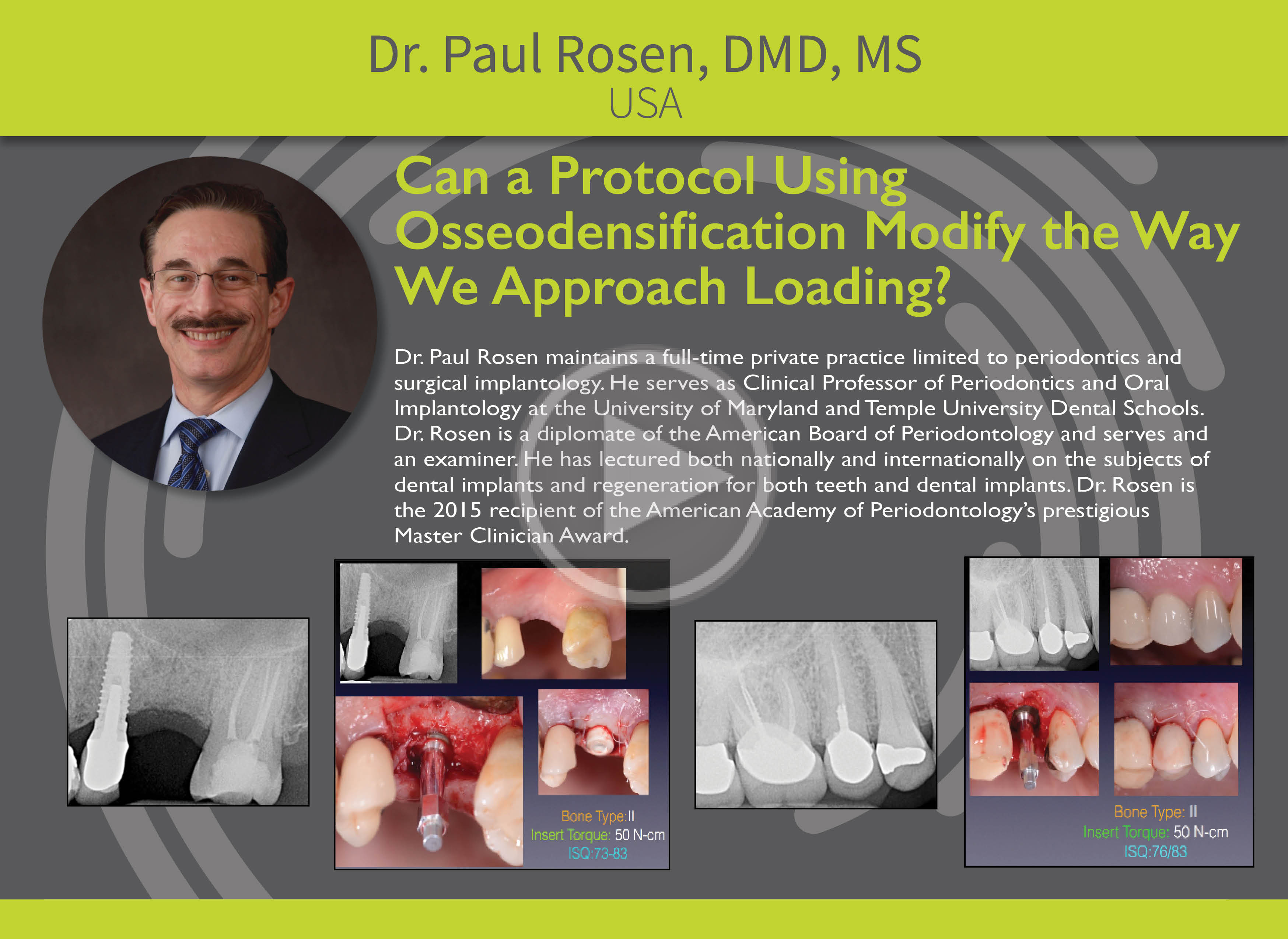 Can Protocol Using Osseodensification Modify Loading?