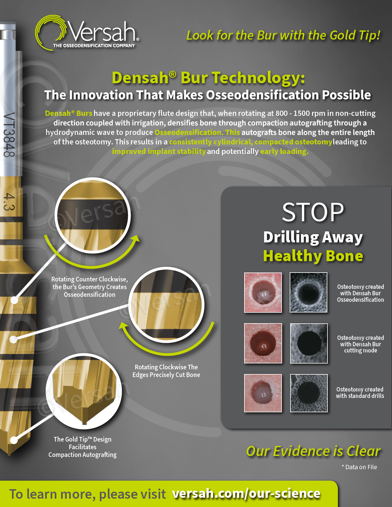 Innovation, Gold Tip, flute design, non-cutting direction, irrigation, consistently cylindrical, compacted osteotomy, improved implant stability, early loading