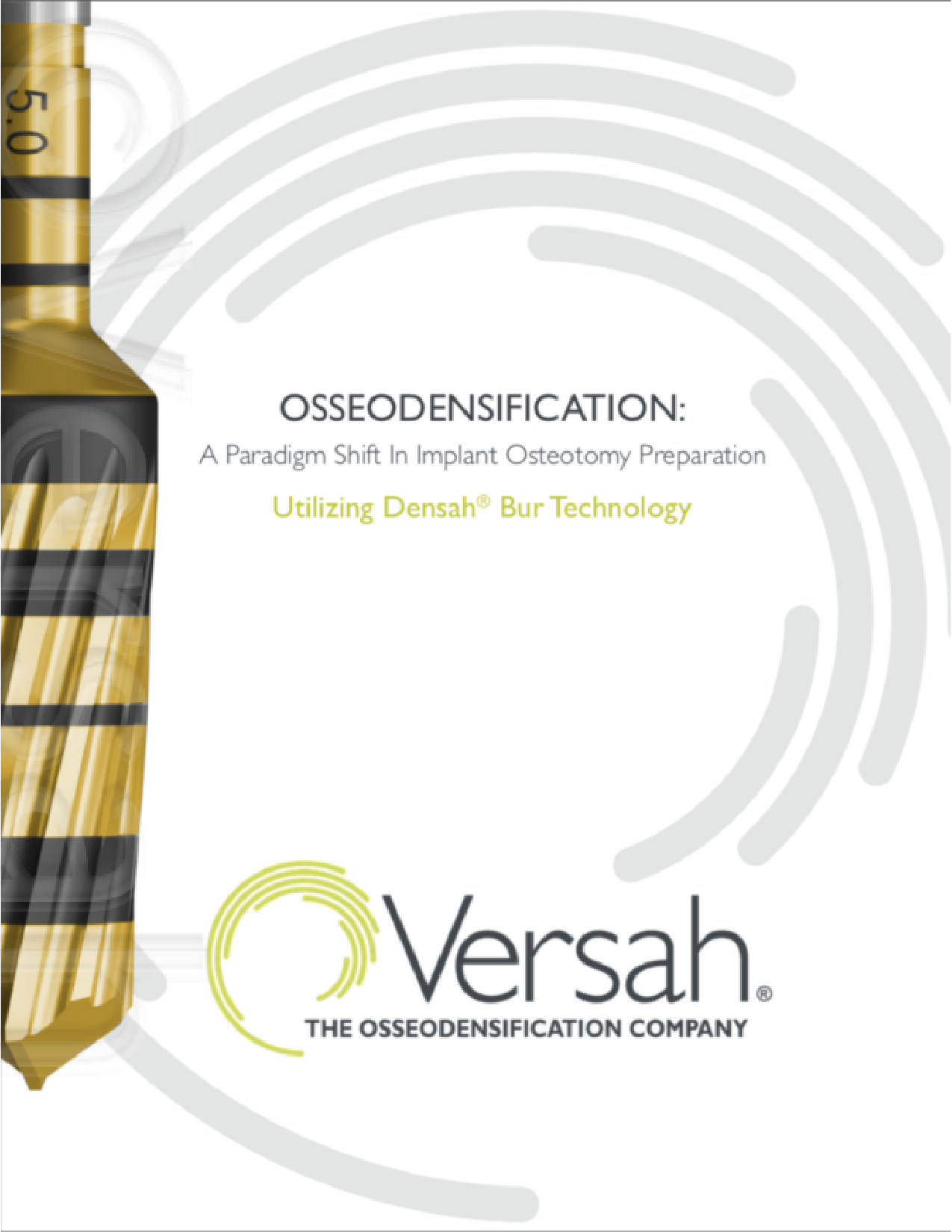 Osseodensification: A Paradigm Shift In Implant Osteotomy Preparation. Utilizing Densah® Bur Technology