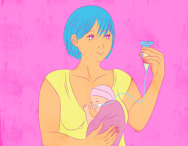 Illustration of a Mother feeding baby with an NG tube 