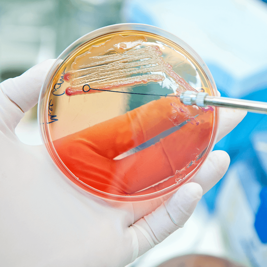 UK Health Authorities Investigate Widespread E.coli Outbreak Ceres Shop