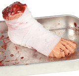 Bandaged Severed Foot