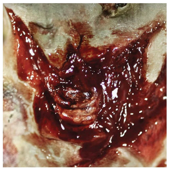 3D Zombie Throat Decay Prosthetic Transfer