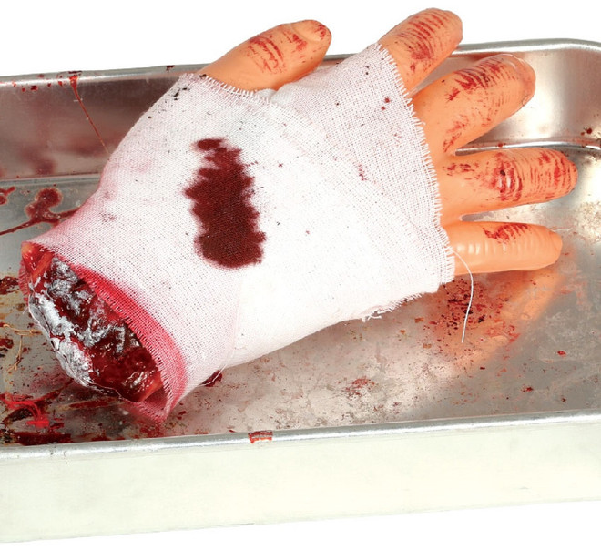 Bandaged Severed Hand