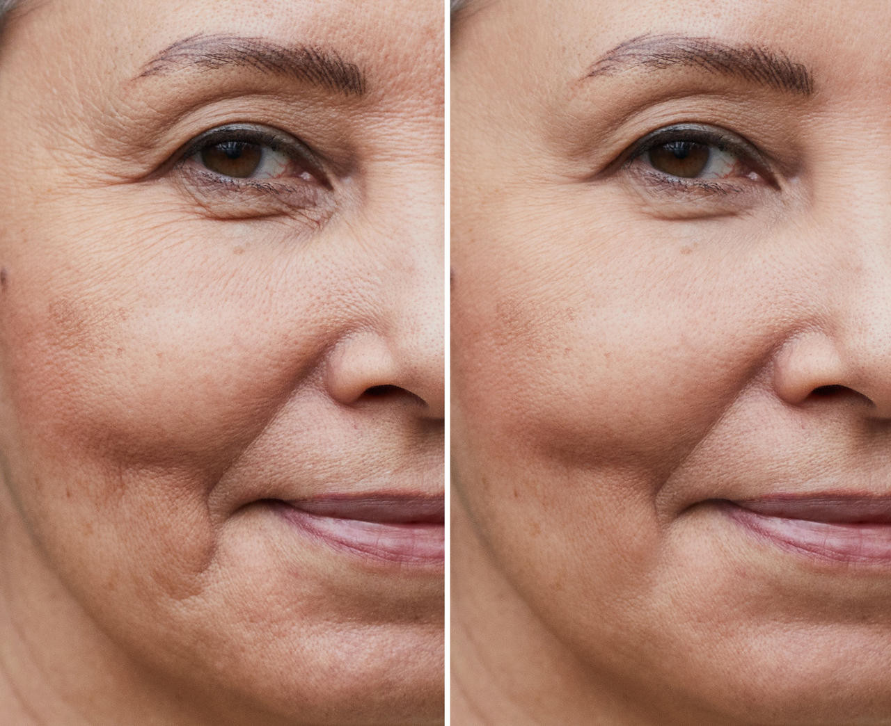 VersaLift® Eye Restore + Lifting Cream - PriyanaMD