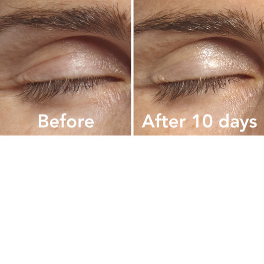 VersaLash® EyeLash & EyeBrow Enhancement Serum