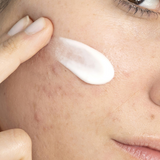 The Ultimate Guide to Understanding Your Skin Type