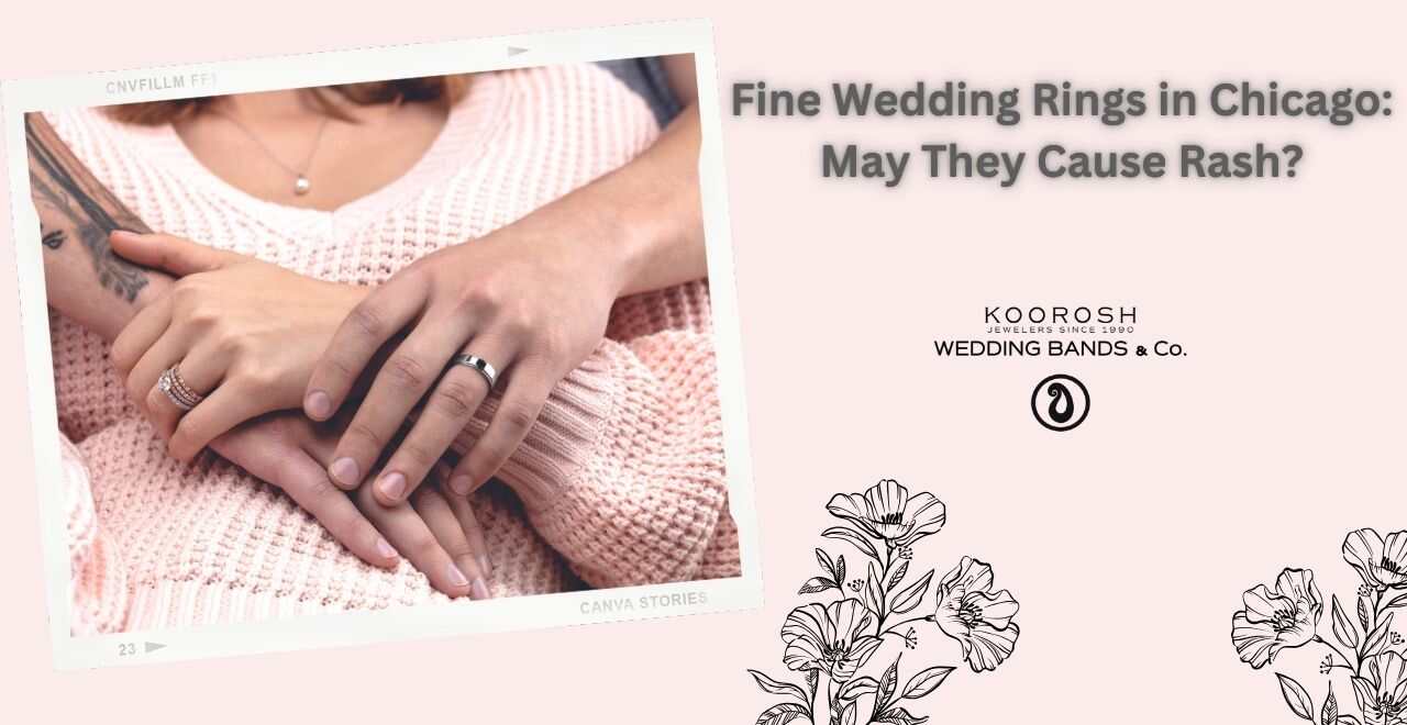 Can Wedding Ring Rash Spread? Wedding Bands & Co.