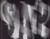 SAP - ALICE IN CHAINS (#886972323220)