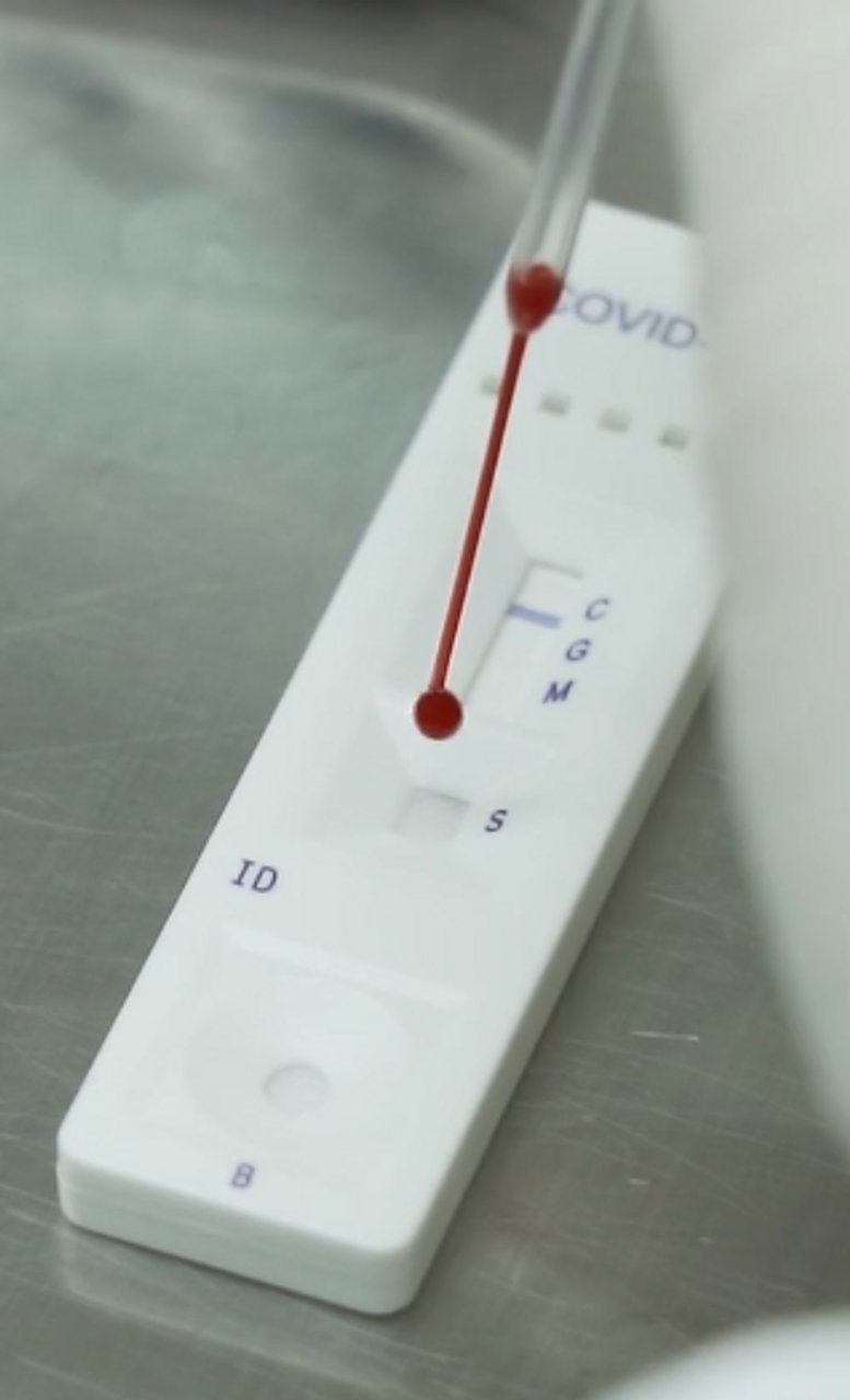 How Do I Perform A Finger-Stick Rapid Antibody Blood Test For COVID-19 And How Do I Read The Results?