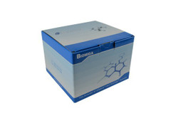 Transfection Kits and Reagents