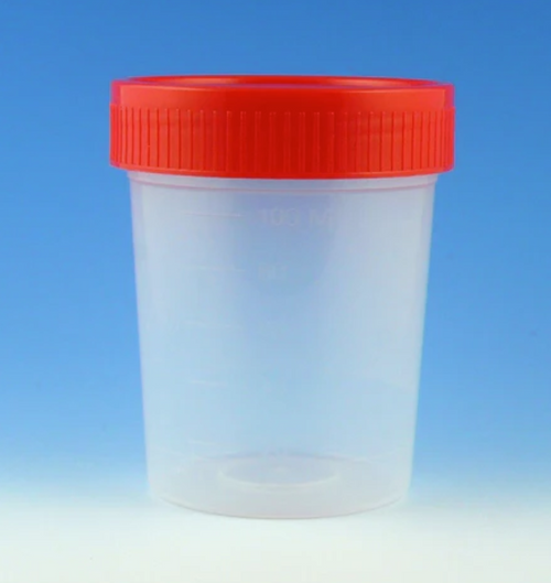 Globe Scientific Non-Sterile 4 Oz Specimen Cup With Trilingual ID Labeling - Clinical Lab Supplies - Stellar Scientific