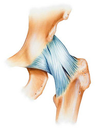 ILIOFEMORAL SPRAIN SYMPTOMS AND TREATMENT