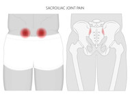 SI JOINT PAIN CAUSES AND SOLUTIONS
