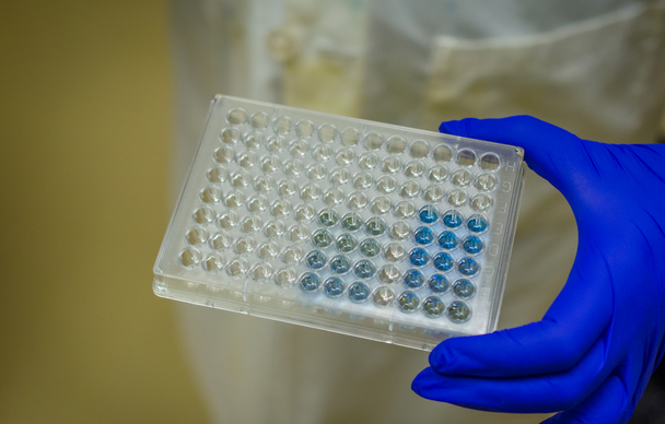 Chondroitin Sulfate ELISA Kit