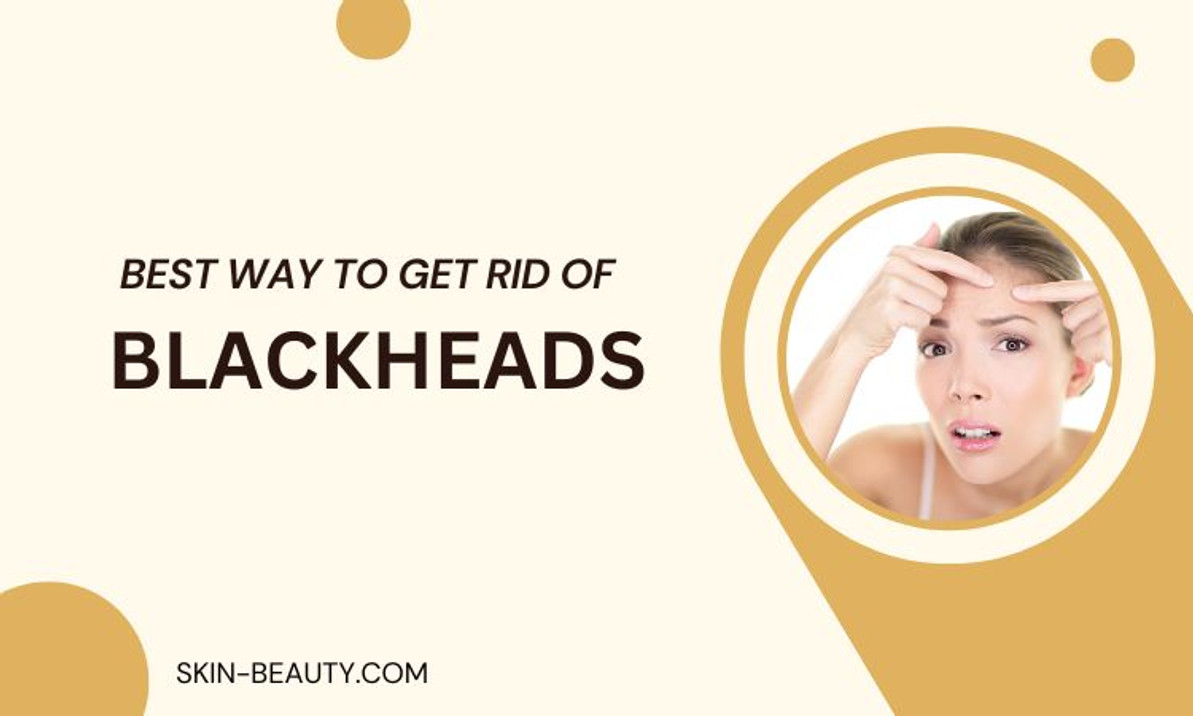 Best Way to Get Rid of Blackheads Best Way to Get Rid of Blackheads