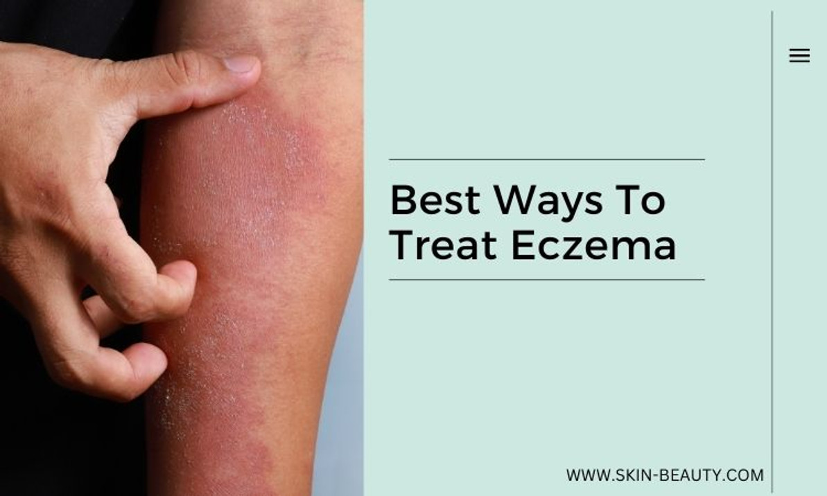 What is Atopic Dermatitis And The Best Remedies for Eczema What is Atopic Dermatitis And The Best Remedies for Eczema