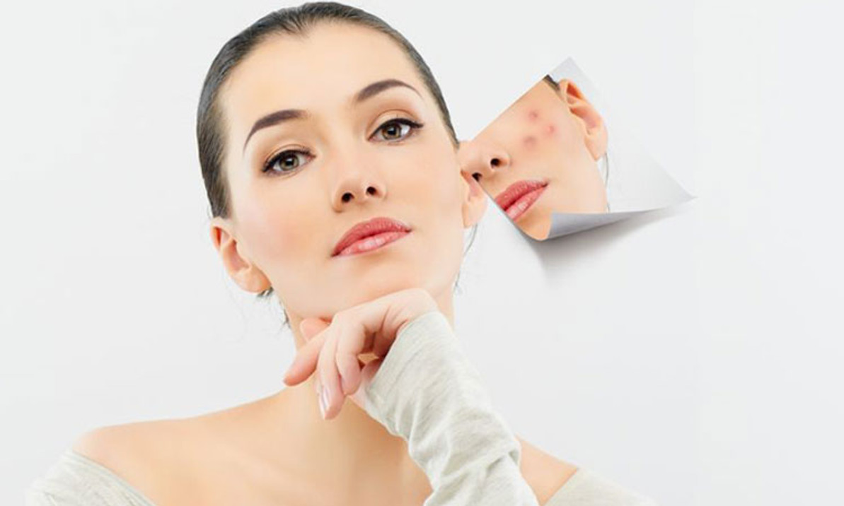 How to Eliminate Spots On My Face