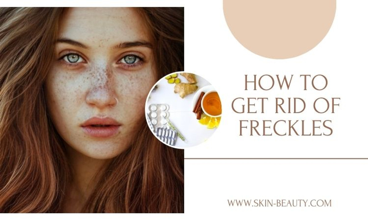 How to Get Rid of Freckles and Achieve a Clear, Glowing Complexion Skin Beauty