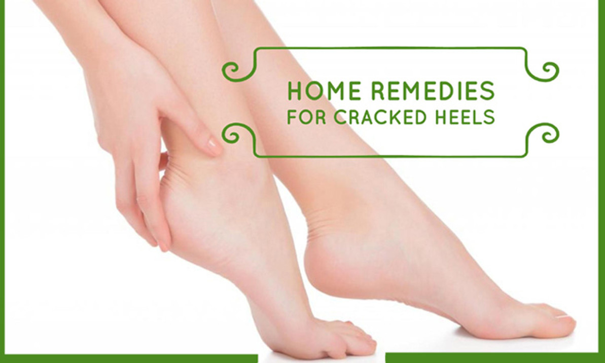 Cracked Heels | Podiatrists in Chicago