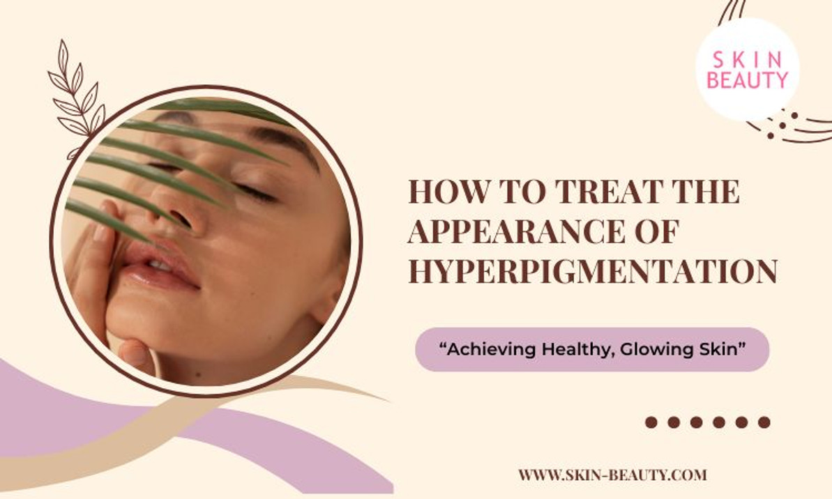 Treatment of Hyperpigmentation Treatment of Hyperpigmentation