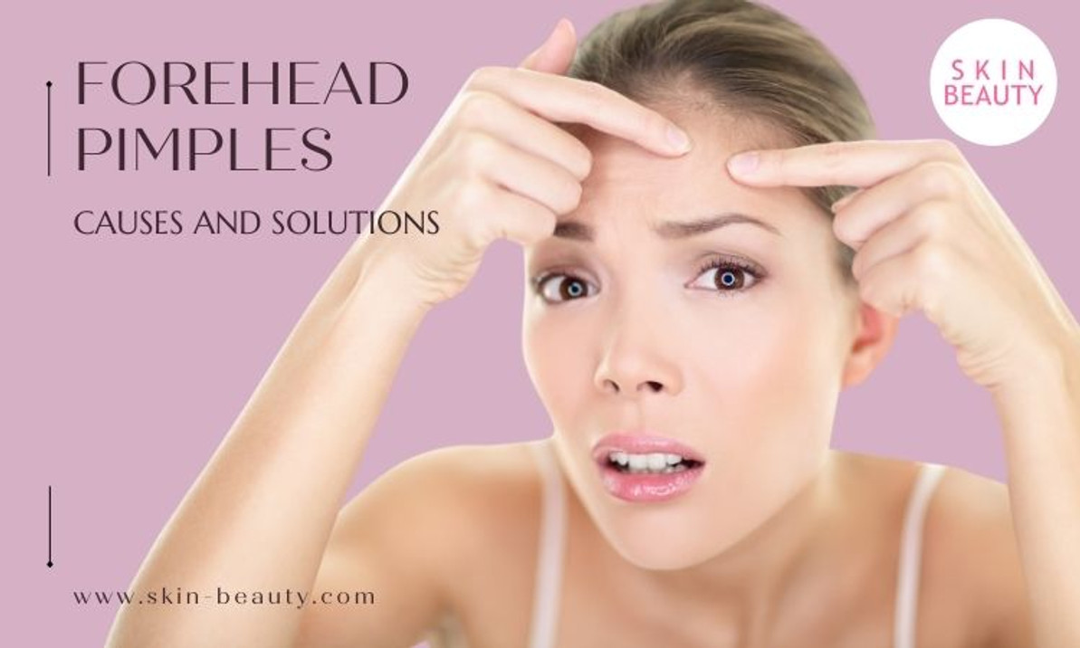 Forehead Pimples Causes, Prevention, and Treatment Forehead Pimples Causes, Prevention, and Treatment