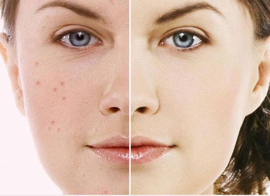 Proven Skin Care Advice For Healthy Skin