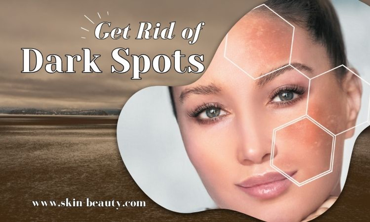 Top 3 Dermatology Treatments to Get Rid of Dark Spots According to Dermatologists Top 3 Dermatology Treatments to Get Rid of Dark Spots According to Dermatologists