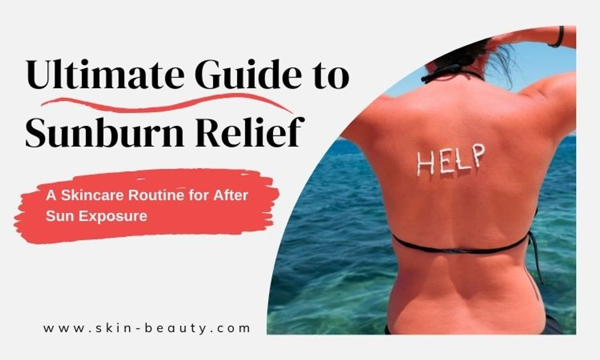 Ultimate Guide to Soothing Sunburn: 4 Skincare Essentials Ultimate Guide to Soothing Sunburn: 4 Skincare Essentials