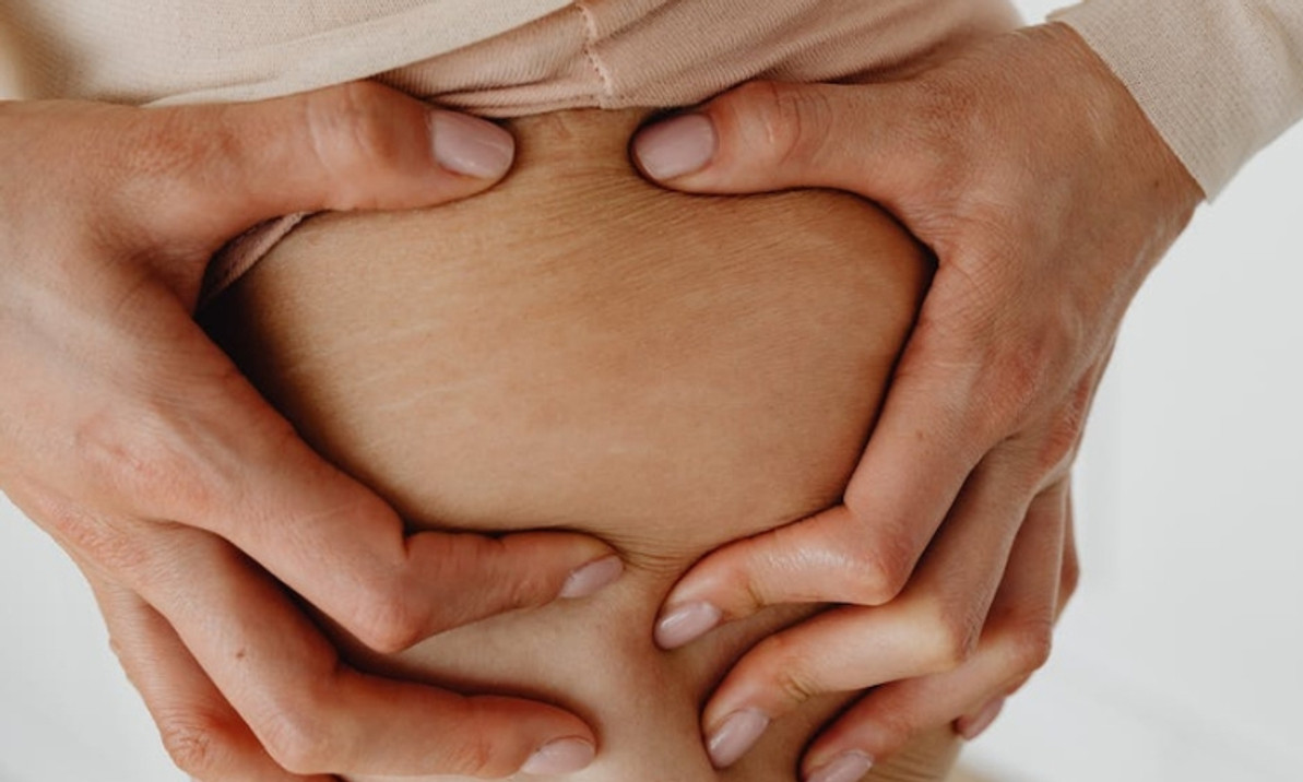 Unlock the Secrets to Getting Rid of Stretch Marks Unlock the Secrets to Getting Rid of Stretch Marks